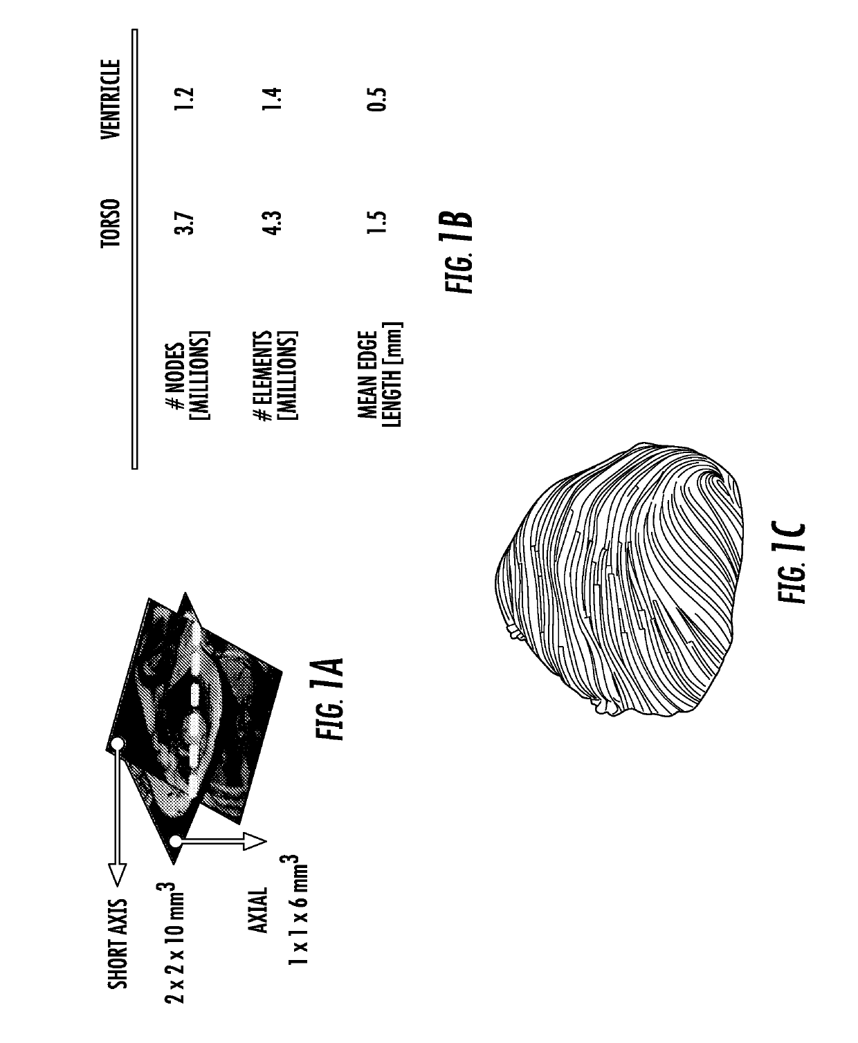 Method for computationally predicting optimal placement sites for internal defibrillators in pediatric and congenital heart defect patients