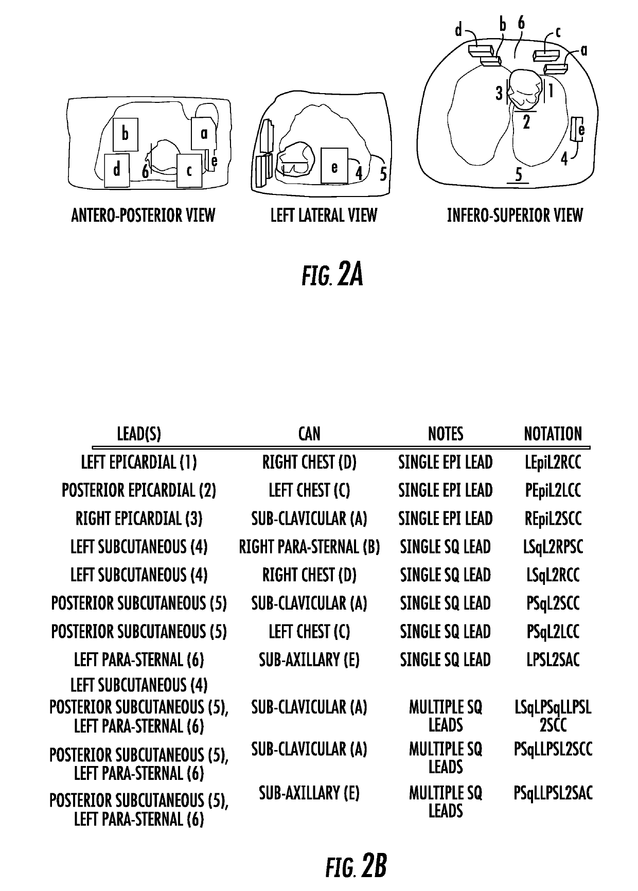 Method for computationally predicting optimal placement sites for internal defibrillators in pediatric and congenital heart defect patients