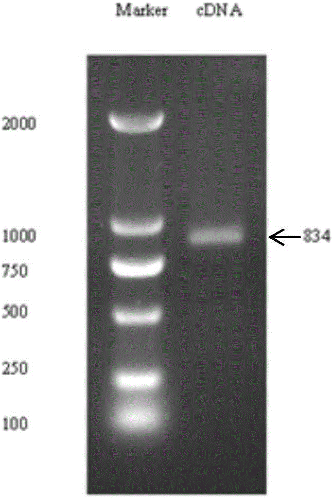 A sipunculus nudus plasmin cDNA gene, a recombined plasmin and applications of the recombined plasmin