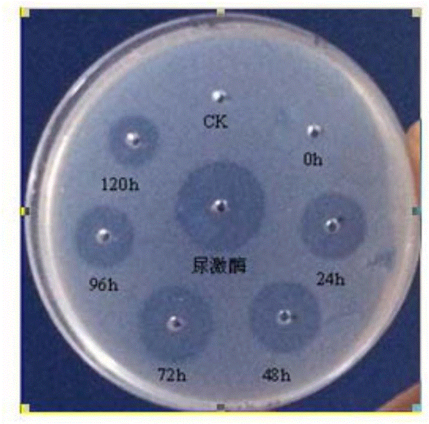 A sipunculus nudus plasmin cDNA gene, a recombined plasmin and applications of the recombined plasmin