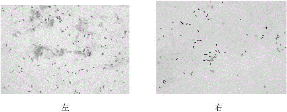 Method for extracting bacterial outer membrane vesicles