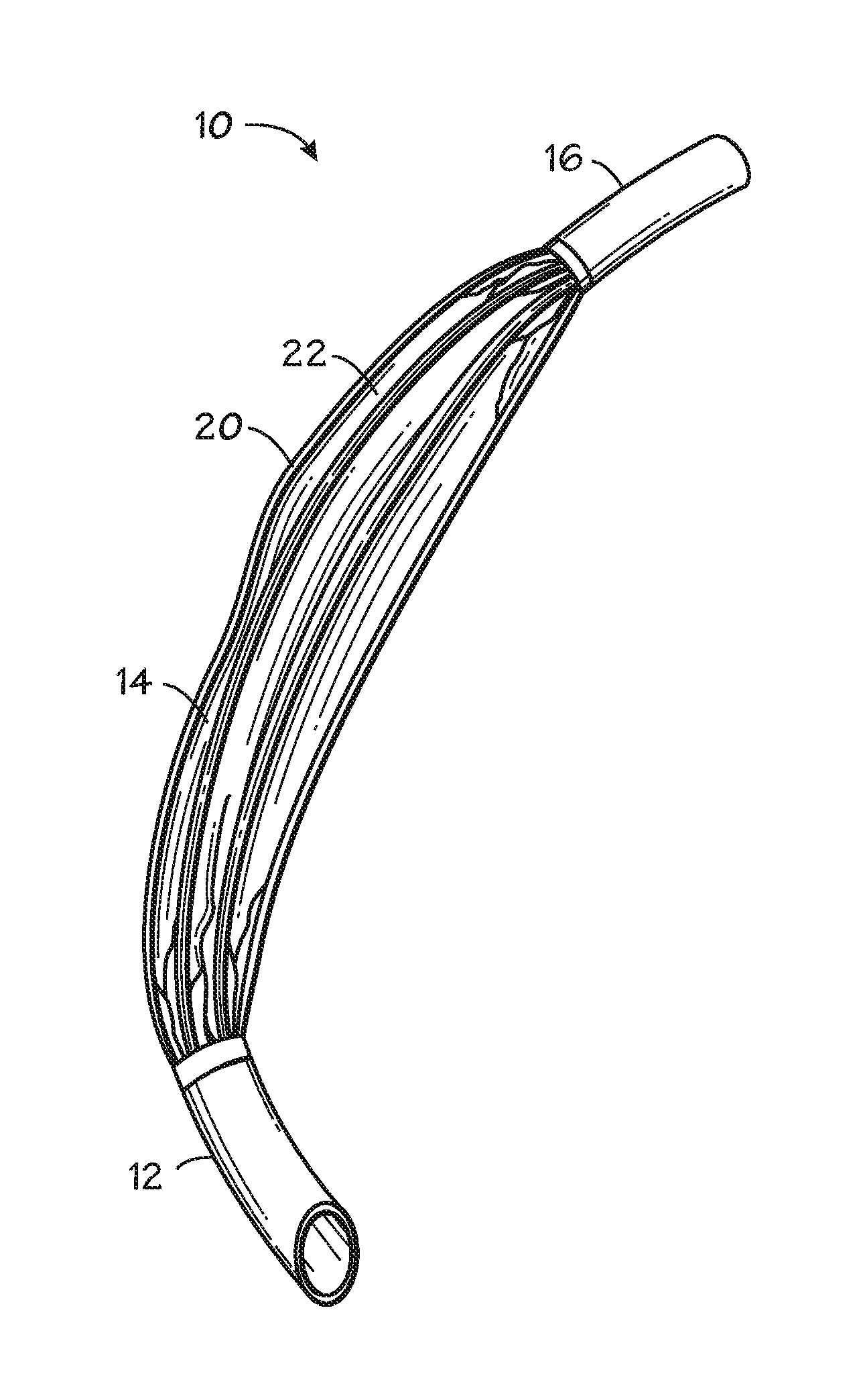 Self-sizing adjustable endotracheal tube