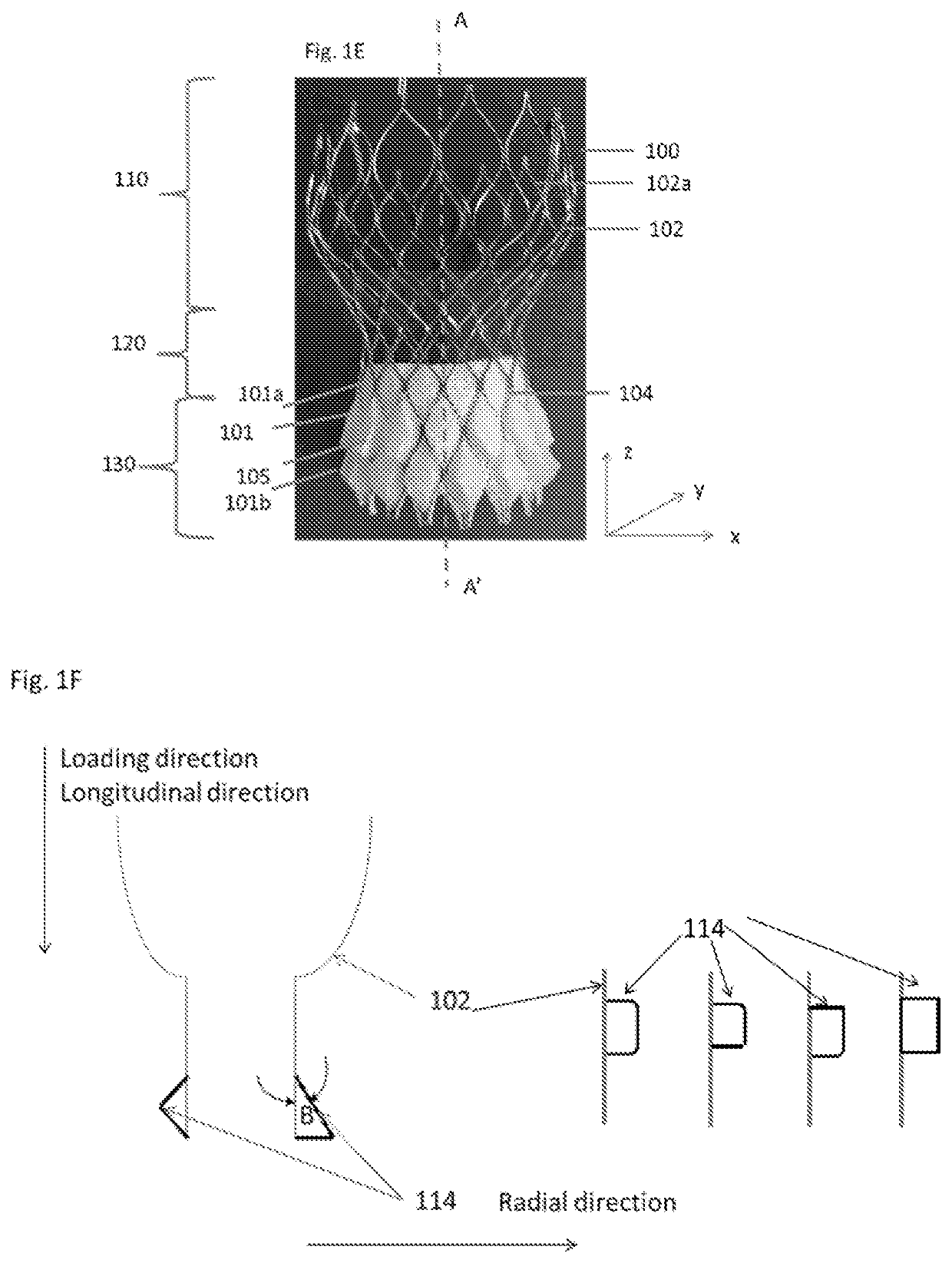 Expandable sealing skirt technology for leak-proof endovascular prostheses