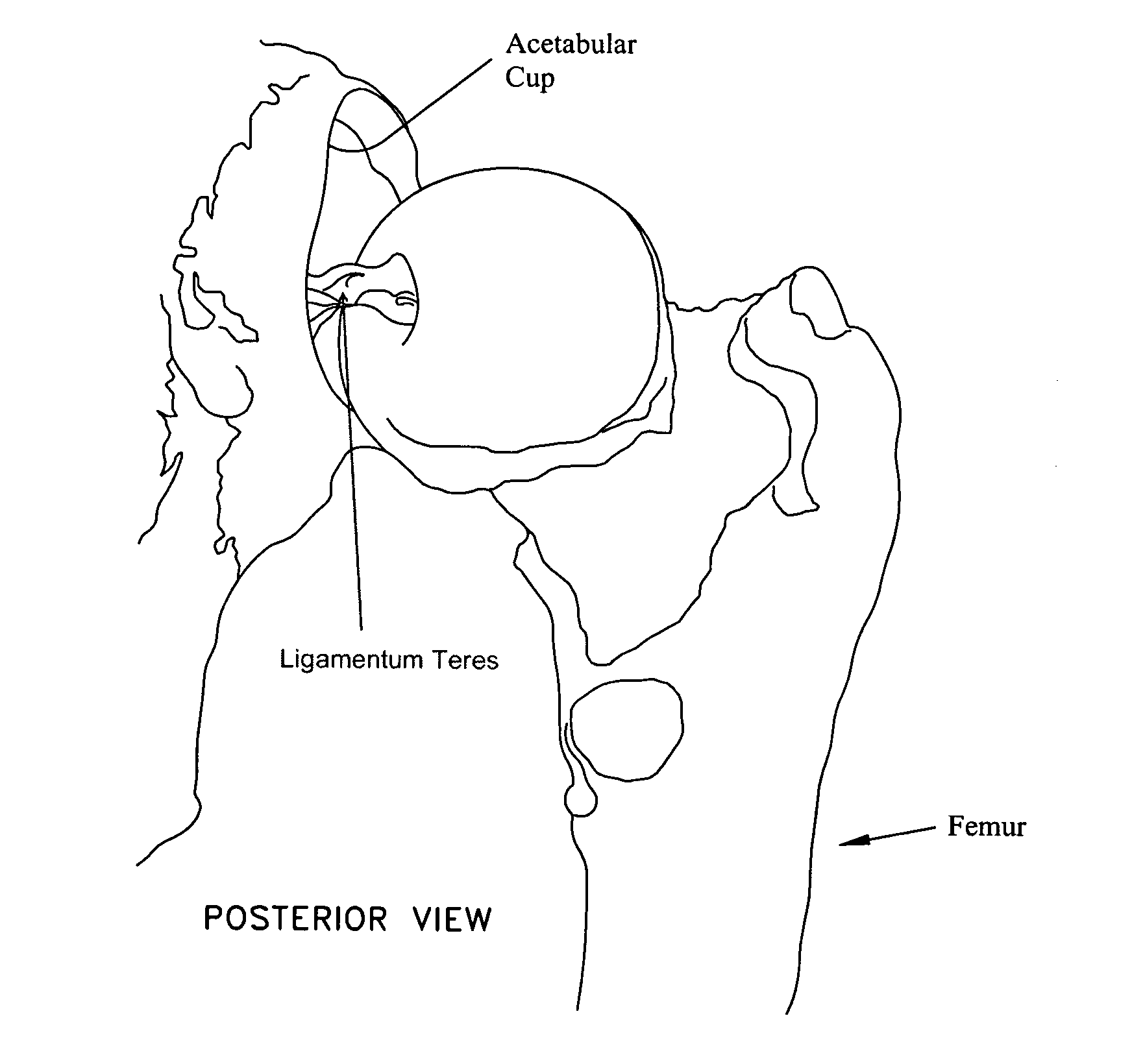 Method and apparatus for re-attaching the labrum of a hip joint