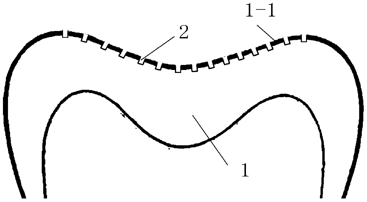 Pure titanium metal dental crown, restoration body and processing method thereof