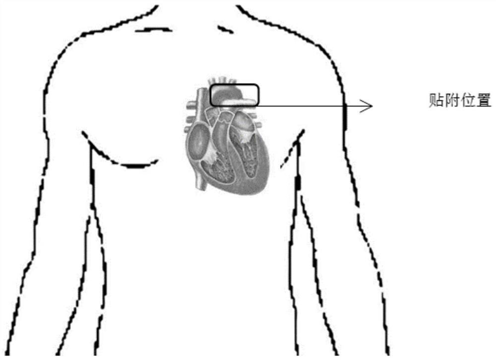A chest non-invasive blood pressure detection method based on pulse wave transit time