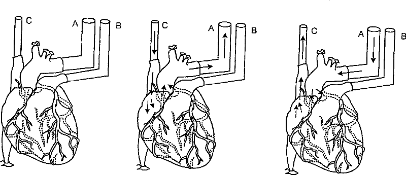 Decellularization and recellularization of organs and tissues