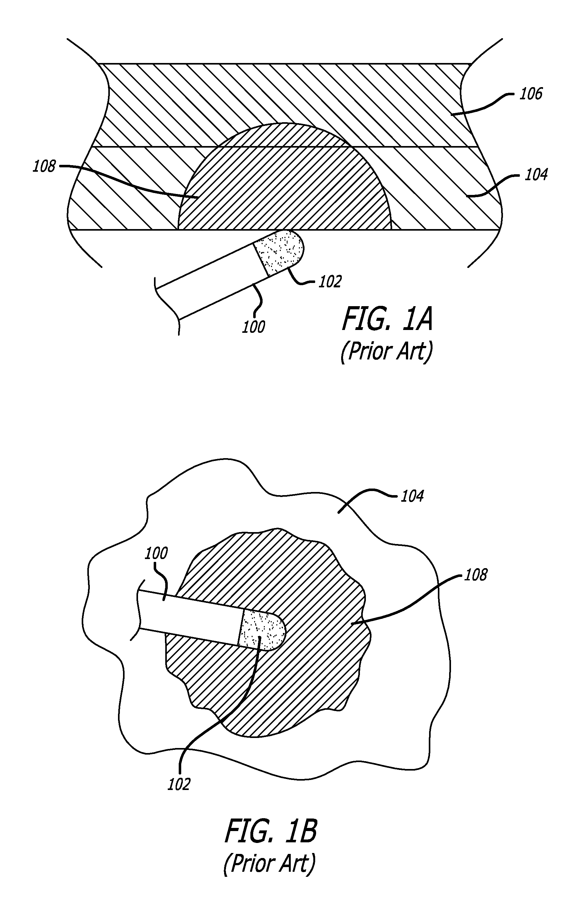 Methods and devices for creating electrical block at specific sites in cardiac tissue with targeted tissue ablation