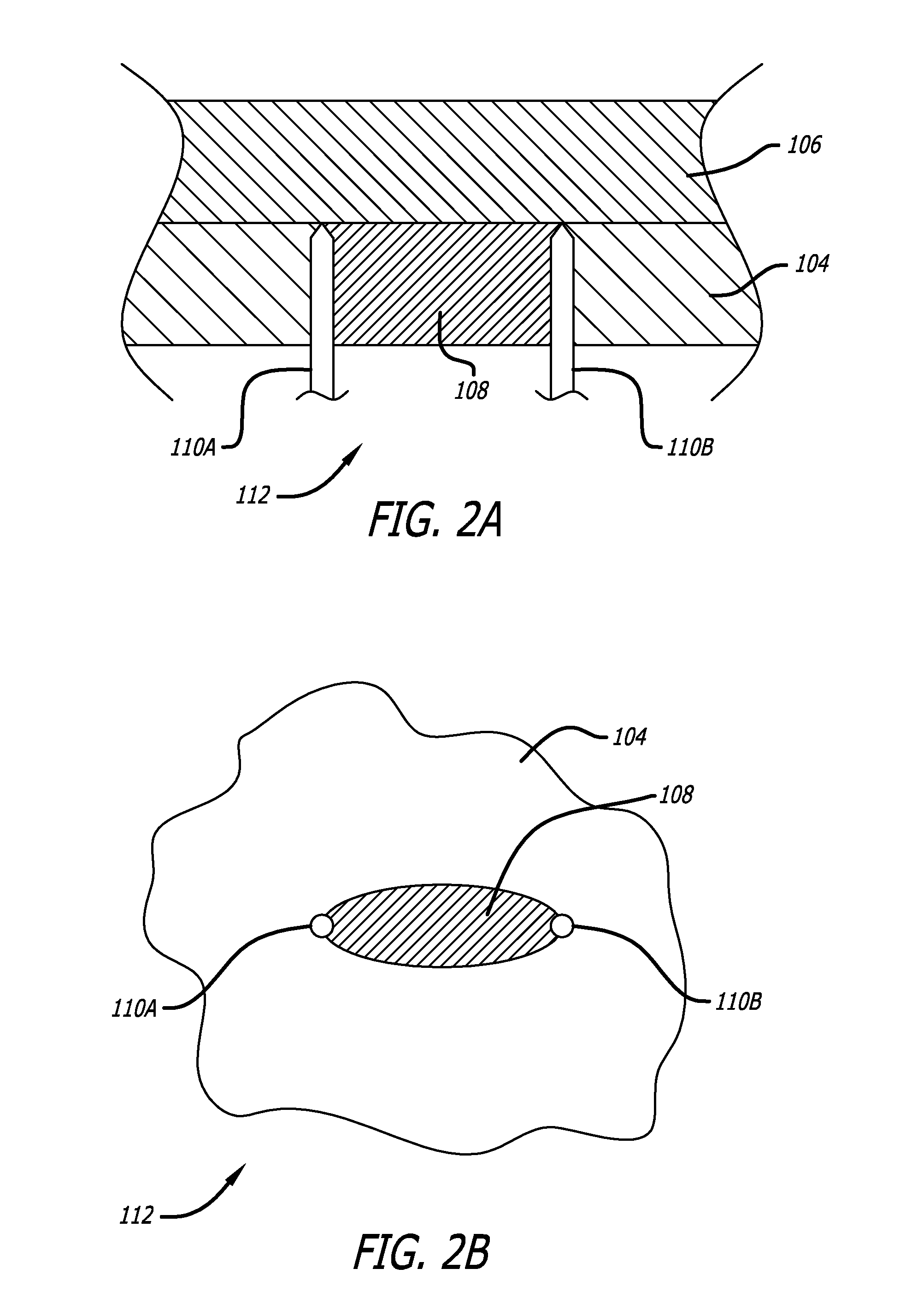 Methods and devices for creating electrical block at specific sites in cardiac tissue with targeted tissue ablation