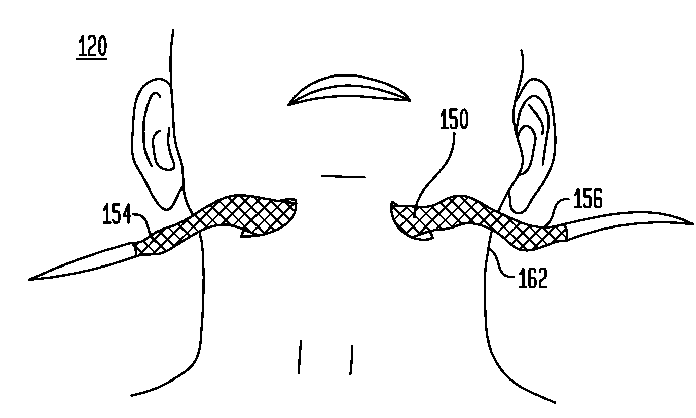 Methods and devices for the indirect displacement of the hyoid bone for treating obstructive sleep apnea