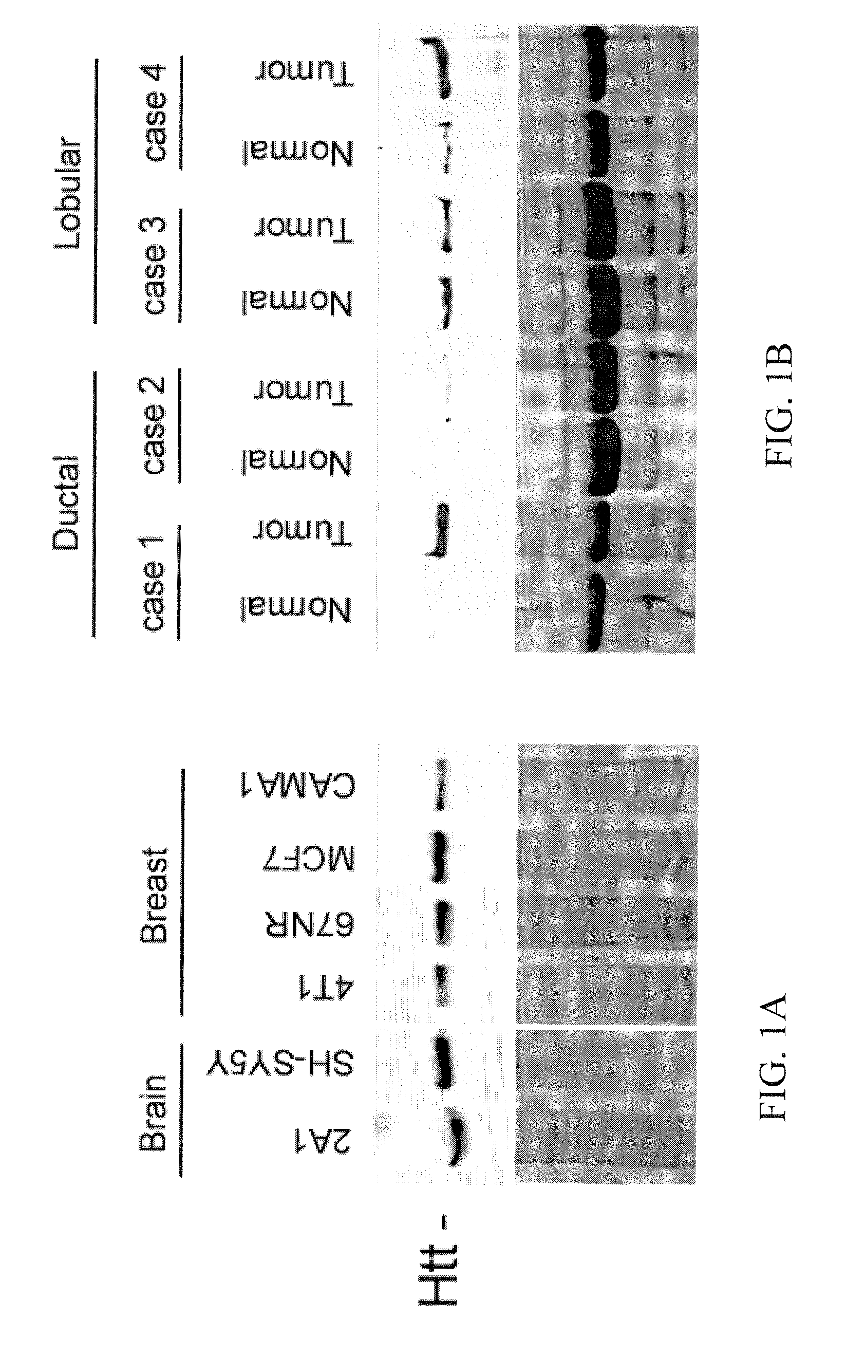 Use of Huntingtin Protein for the Diagnosis and the Treatment of Cancer