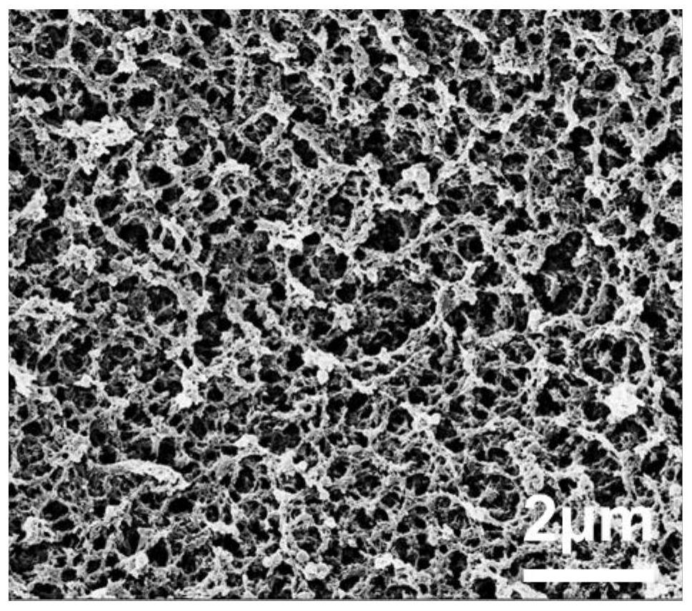 Preparation and application of degradable, biocompatible, high-strength chitin hydrogel