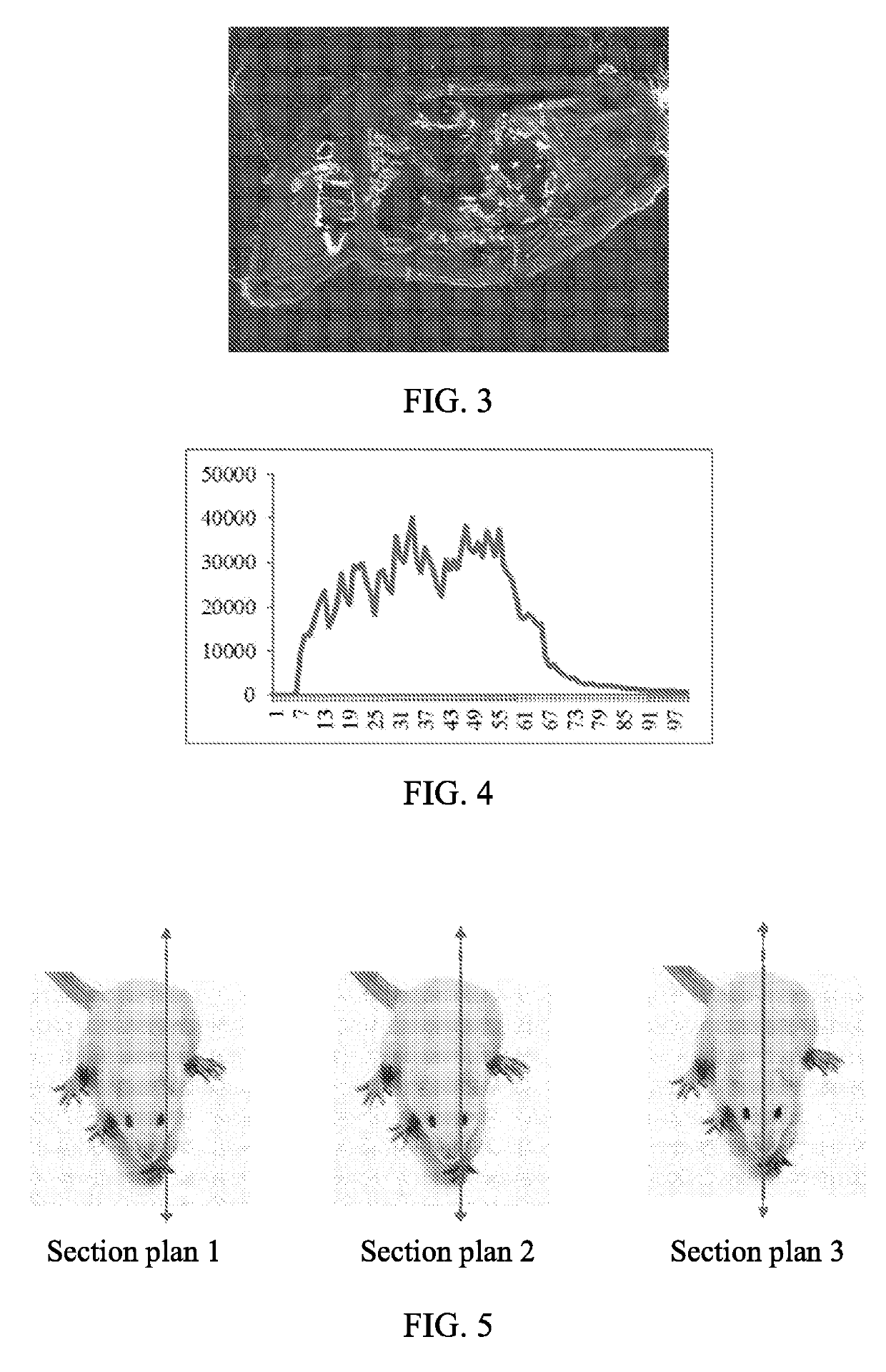 Phosphaplatin compounds as therapeutic agents for treatment of bone or blood cancers