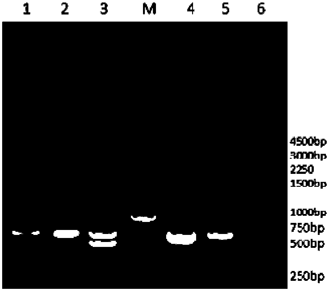 Multiplex PCR primer set, detection method and kit for simultaneously detecting four kinds of pathogenic vibrio bacteria