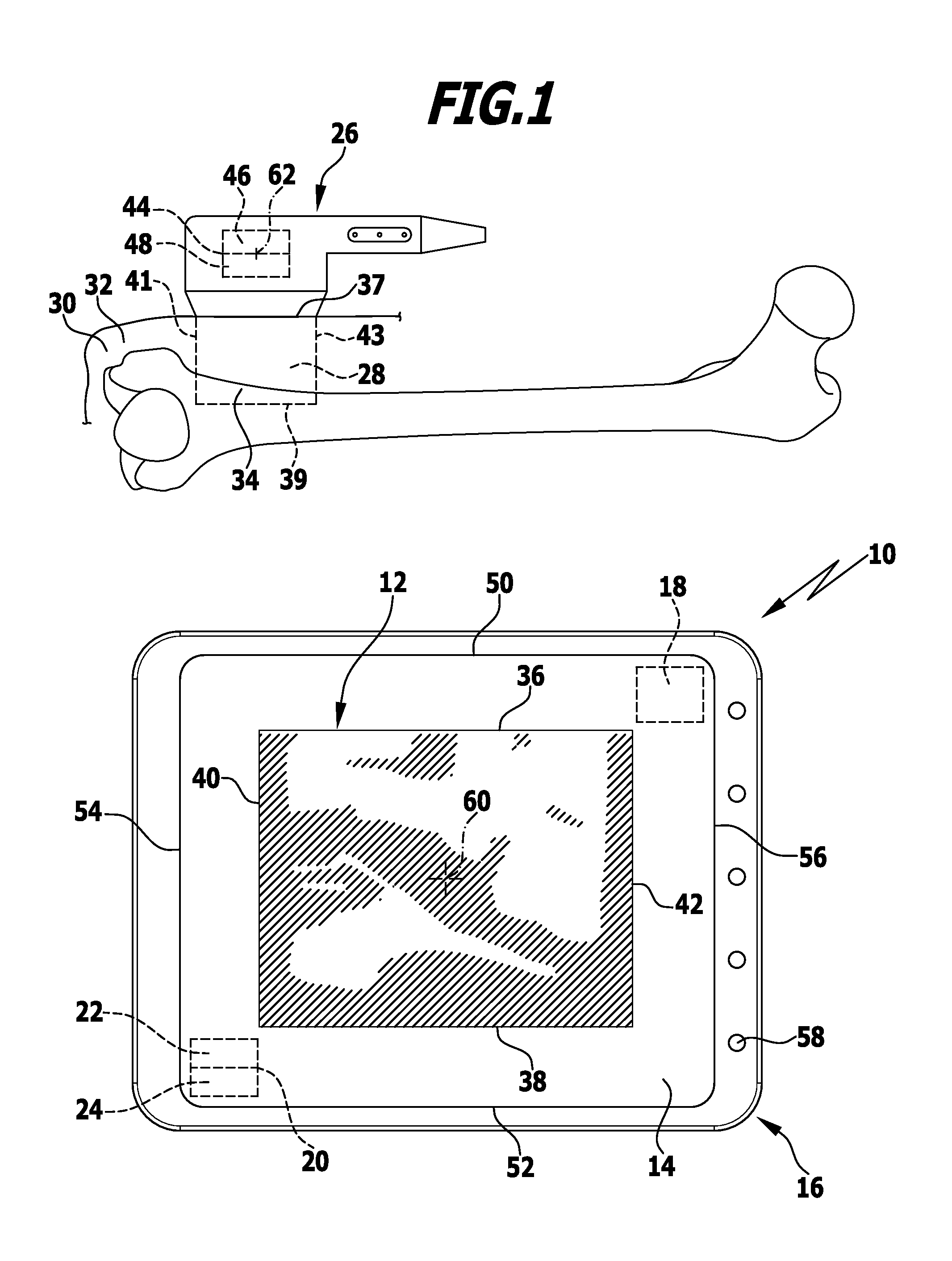 Method and apparatus for displaying an ultrasound image