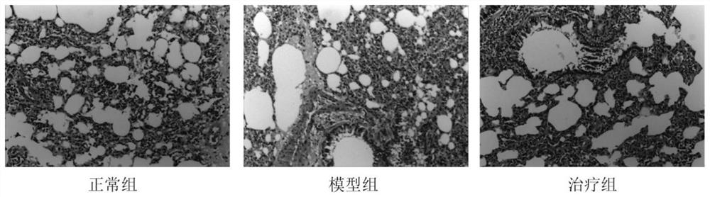 Traditional Chinese medicine composition for treating chronic obstructive pulmonary disease in stable phase and preparation method of traditional Chinese medicine composition