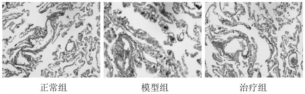 Traditional Chinese medicine composition for treating chronic obstructive pulmonary disease in stable phase and preparation method of traditional Chinese medicine composition