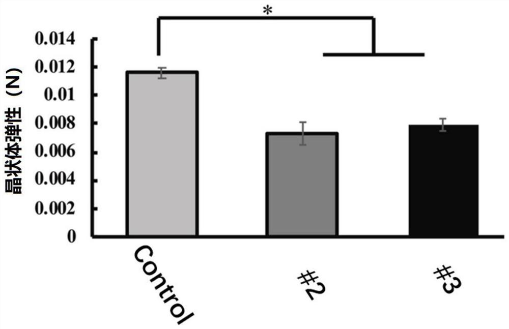 Ophthalmic preparation and application thereof in treating presbyopia