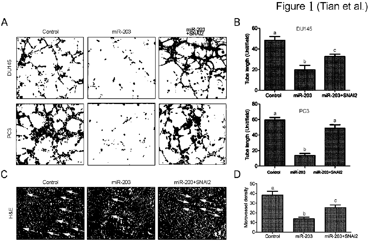 Method for adjusting prostate cancer tumor angiogenesis by utilizing miR-203/SNAI2 axis