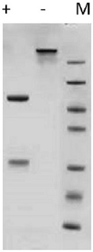 Novel coronavirus Delta mutant strain specific antibody and application thereof
