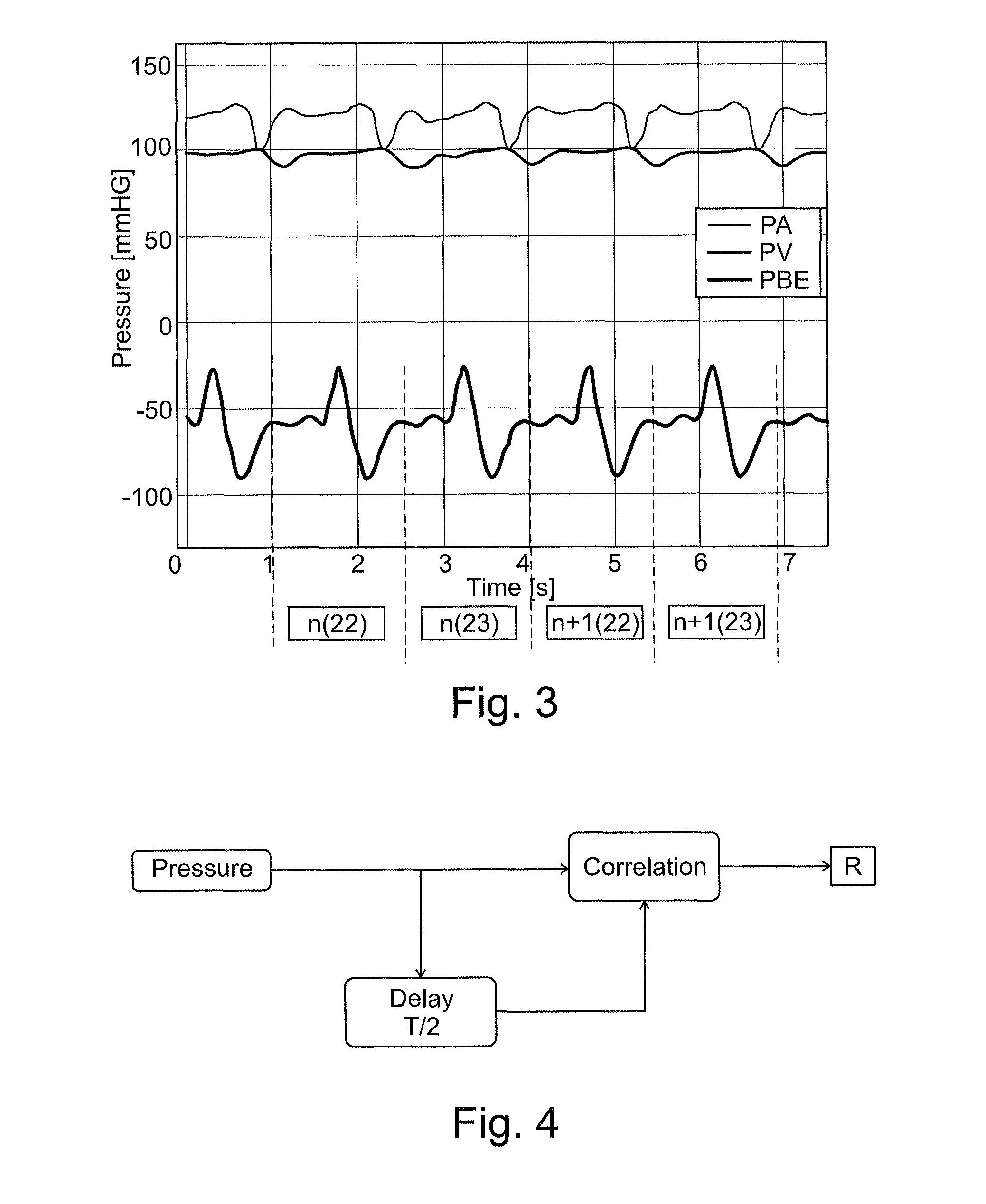 Fluid conveyance monitoring system in an extracorporeal blood treatment device