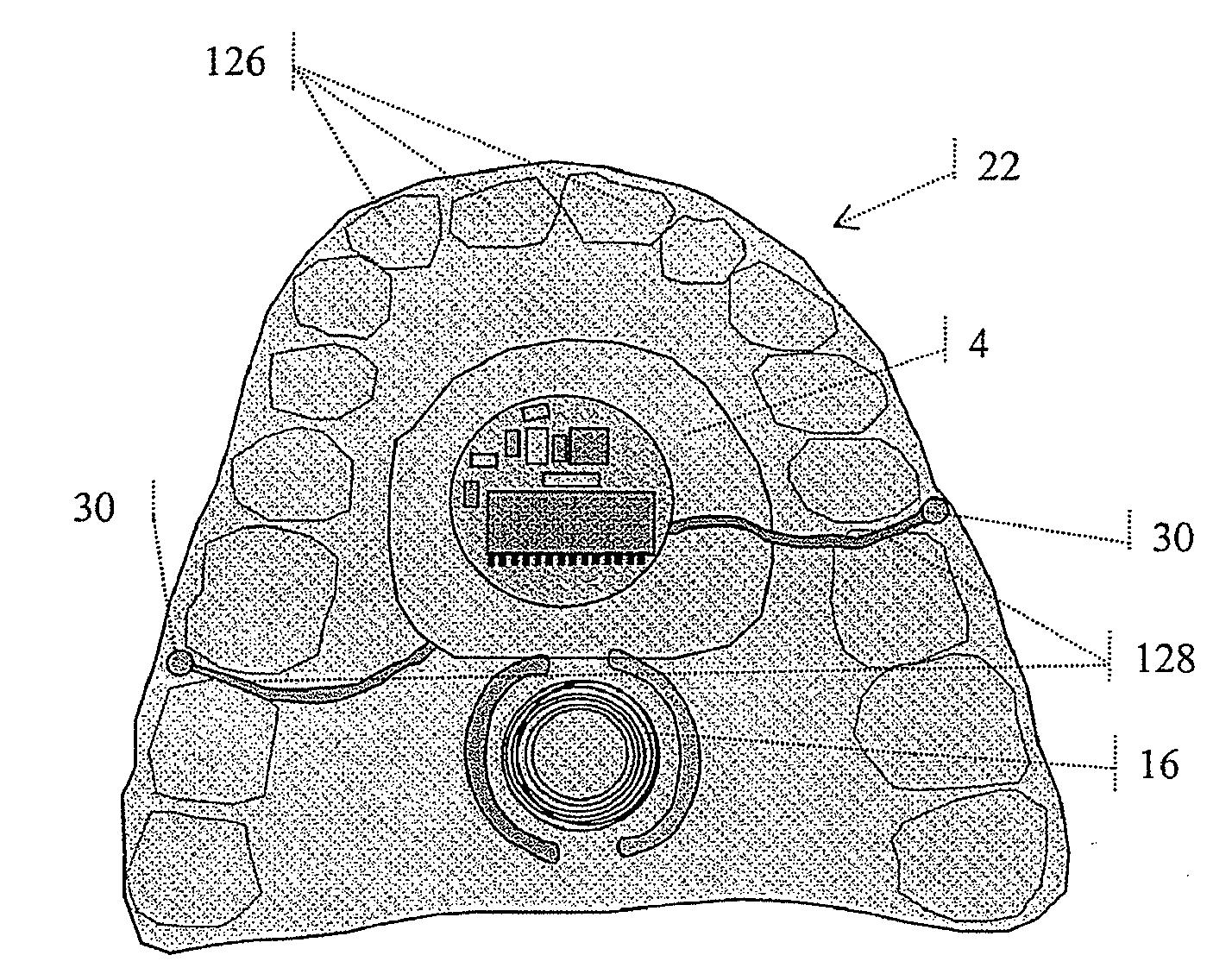 Palatal Implant Fixation Devices and Methods