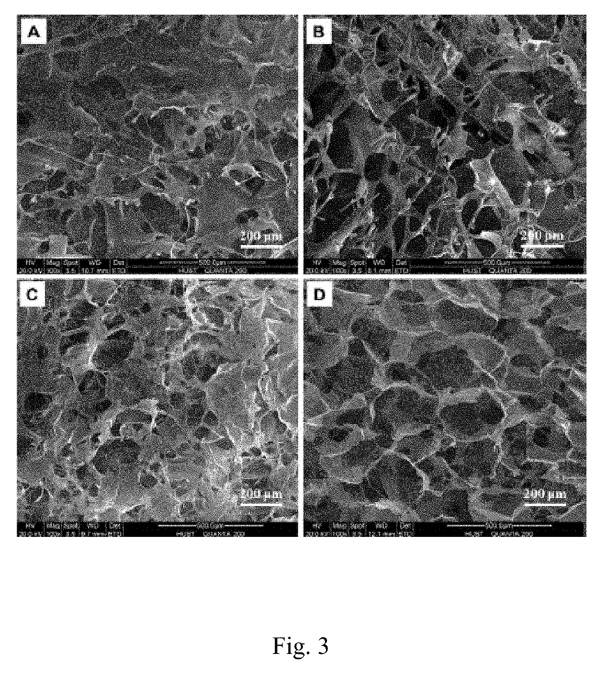 Collagen-silk fibroin co-assembled sponge material, co-assembled artificial skin and preparation method thereof