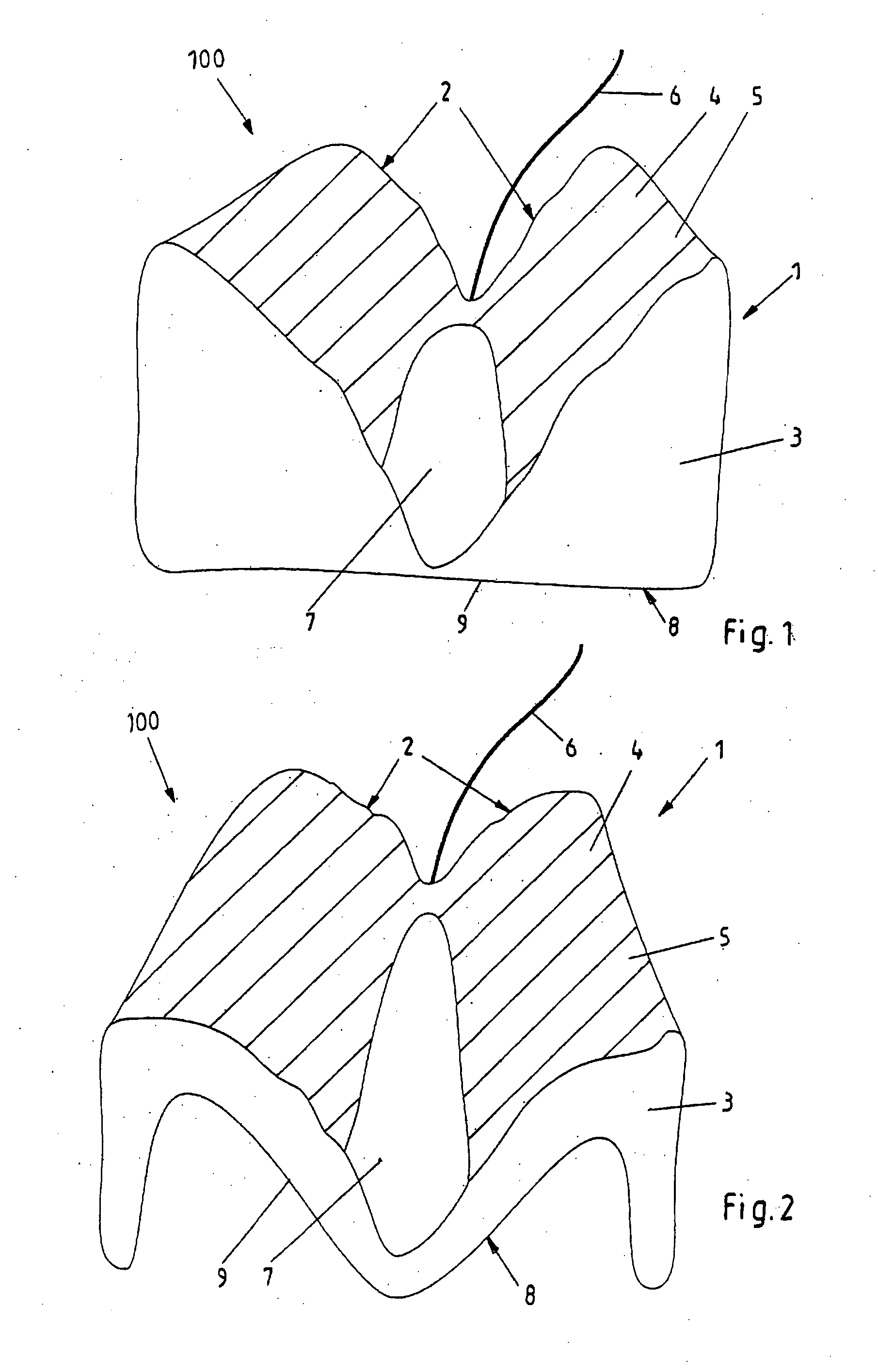 Apparatus for submental electrical stimulation of the supra hyoid muscles of the floor of mouth