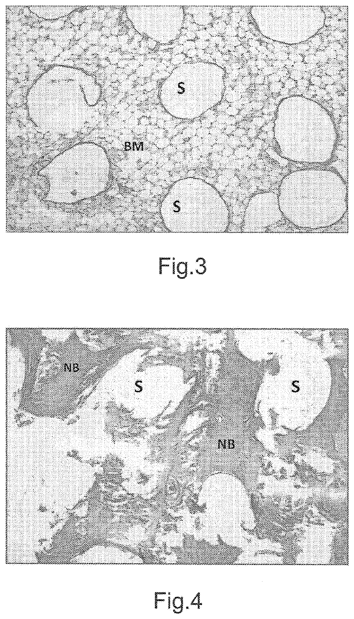 Method for manufacturing bone implants and bone implant