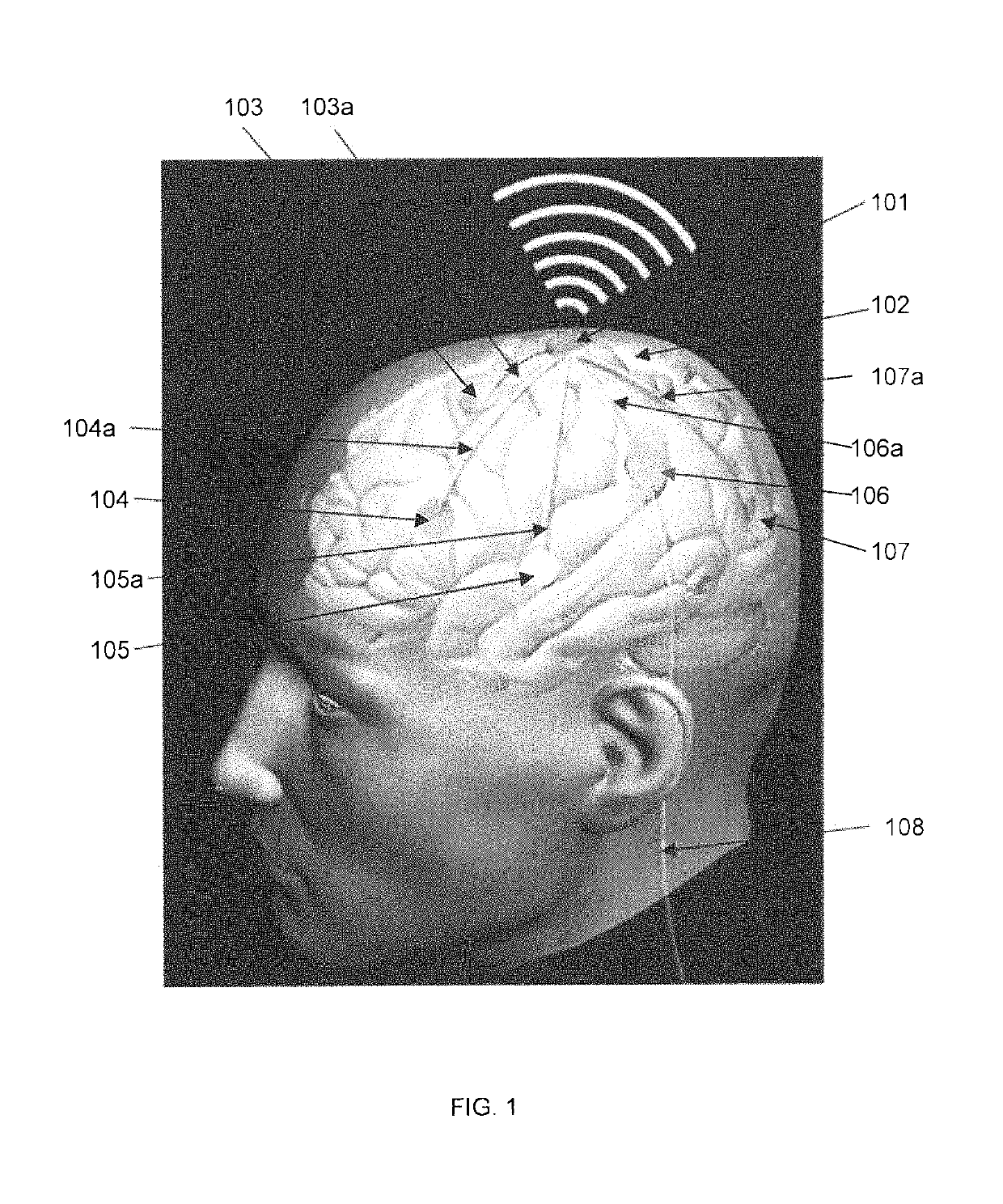 Implantable wireless neural device