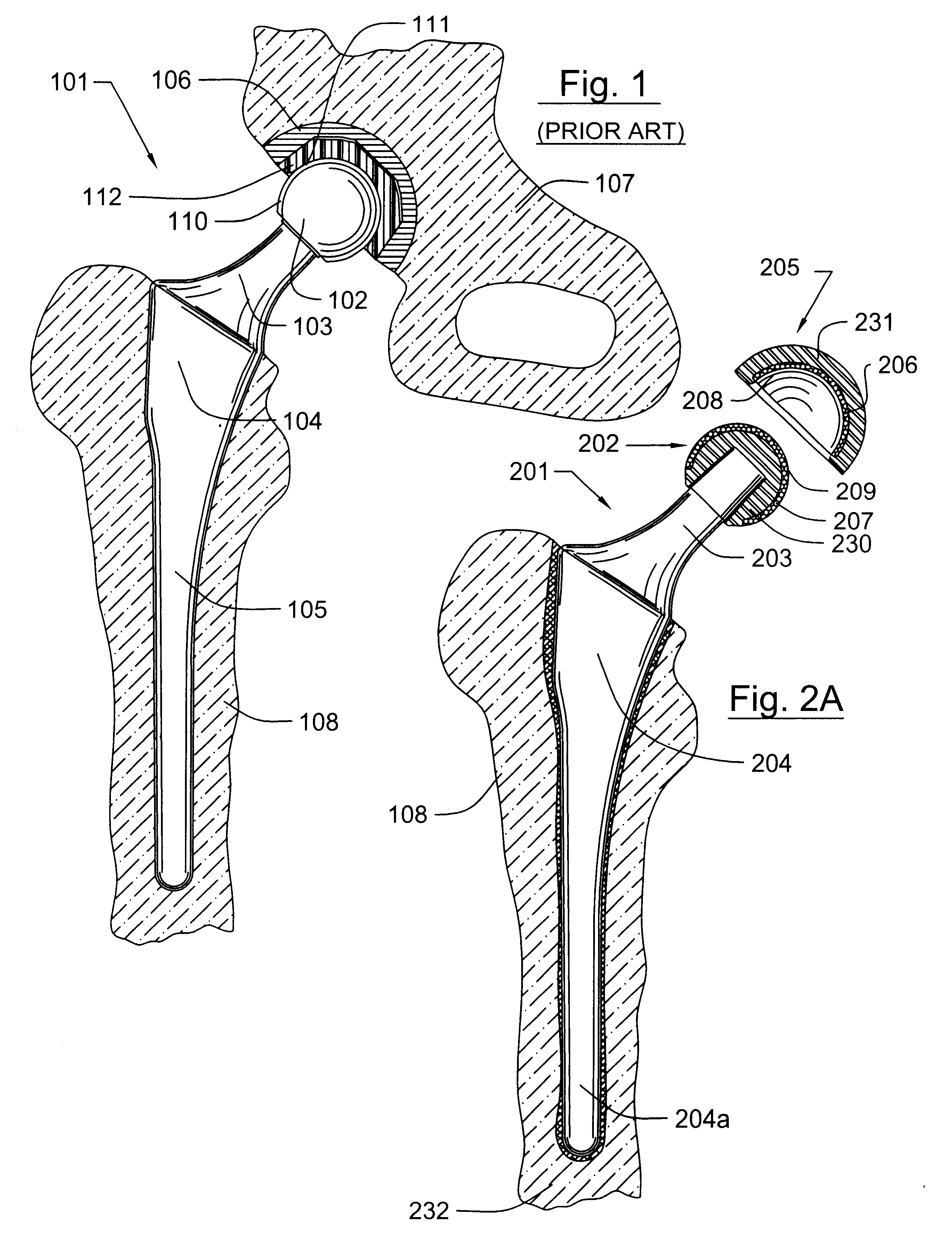 Methods for shaping and finishing prosthetic joint components including polycrystalline diamond compacts