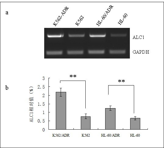 Application of ALC1 to preparation of leukaemia drug resistance reversing agent and as drug-resistant leukaemia diagnosing reagent