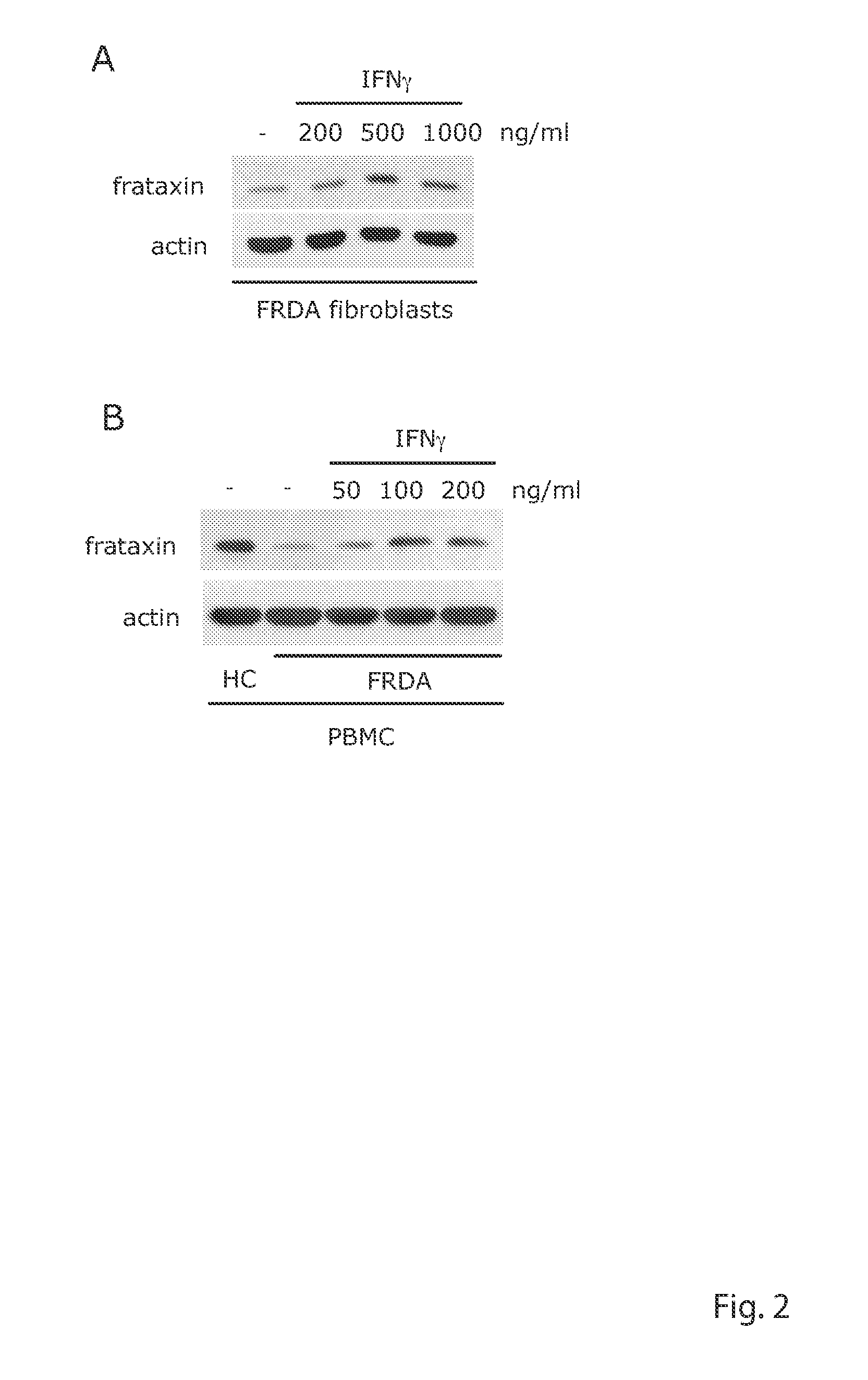 Methods for treating Friedreich's ataxia with interferon gamma