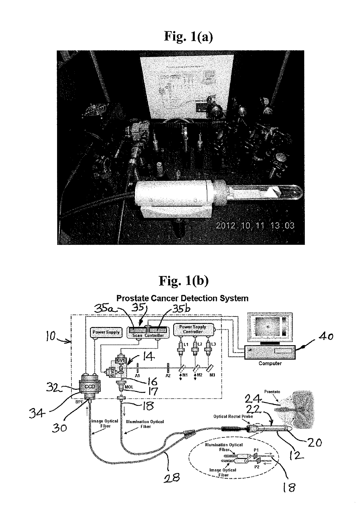 Near infrared photonic prostatoscopy analyzer