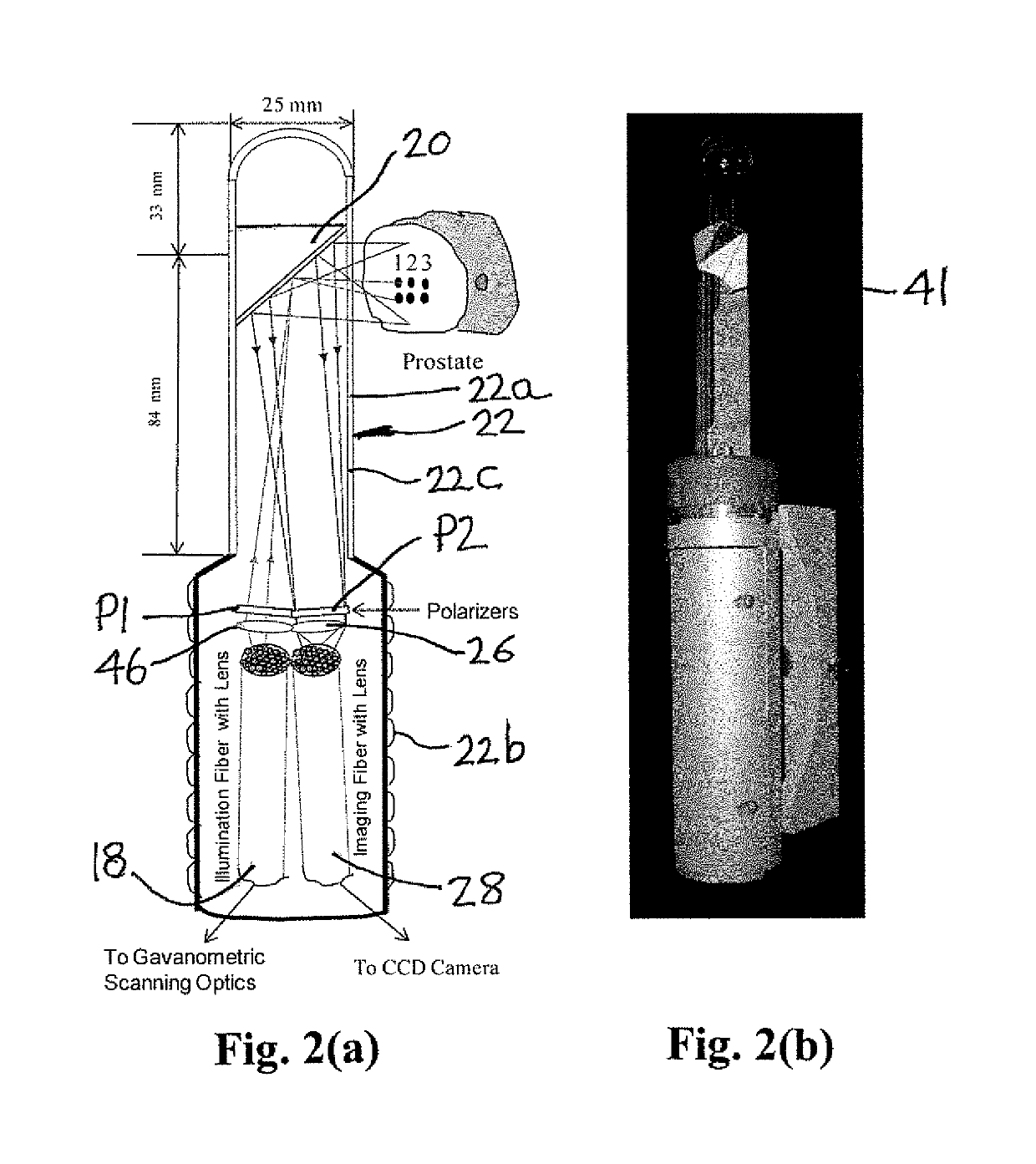 Near infrared photonic prostatoscopy analyzer