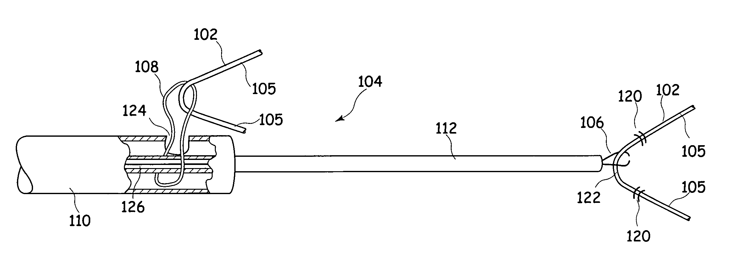 Apparatus for and method of fitting a stent-graft or similar device