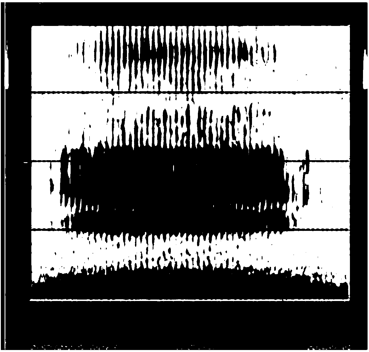 Artificial cochlea acoustic nerve conductive electrode array capable of sensing music melodies