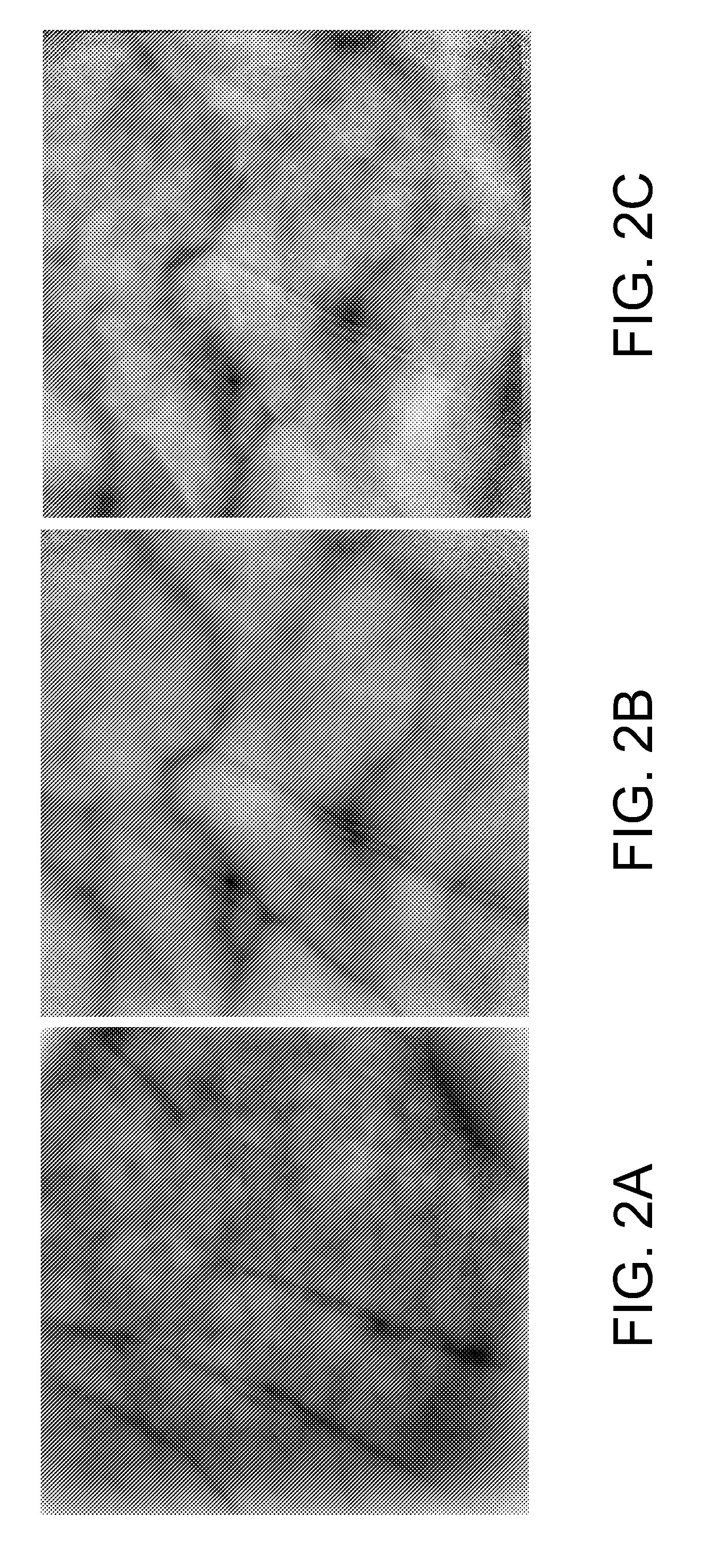 Method and apparatus for projection of subsurface structure onto an object's surface