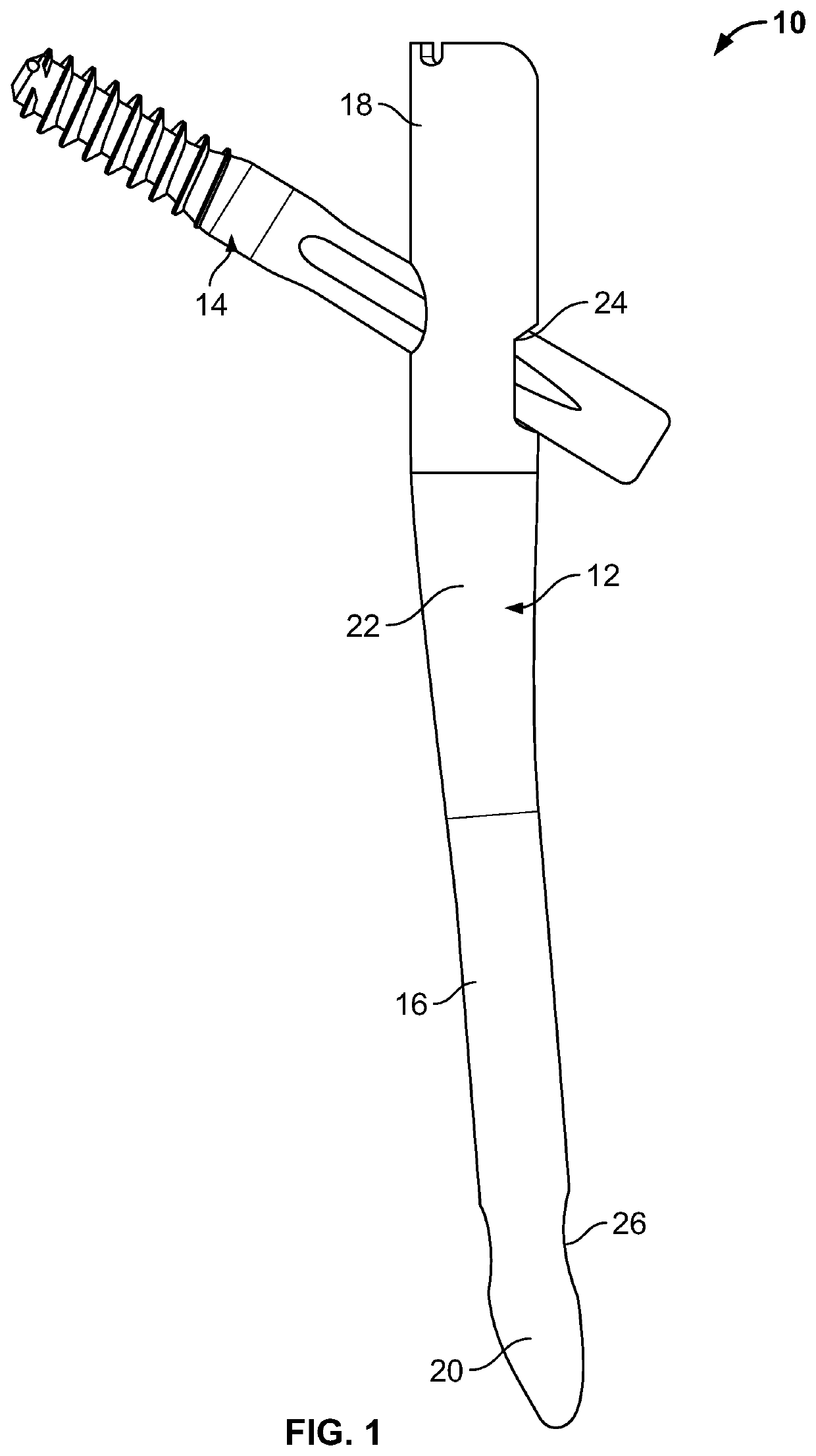 Implant System for Bone Fixation