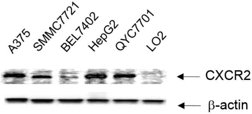 Human-mouse chimeric anti-CXCR2 full-molecule IgG and application thereof