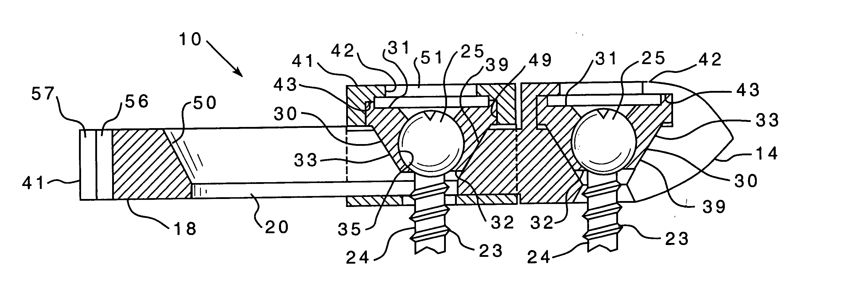 Bone fixation assembly and method of securement