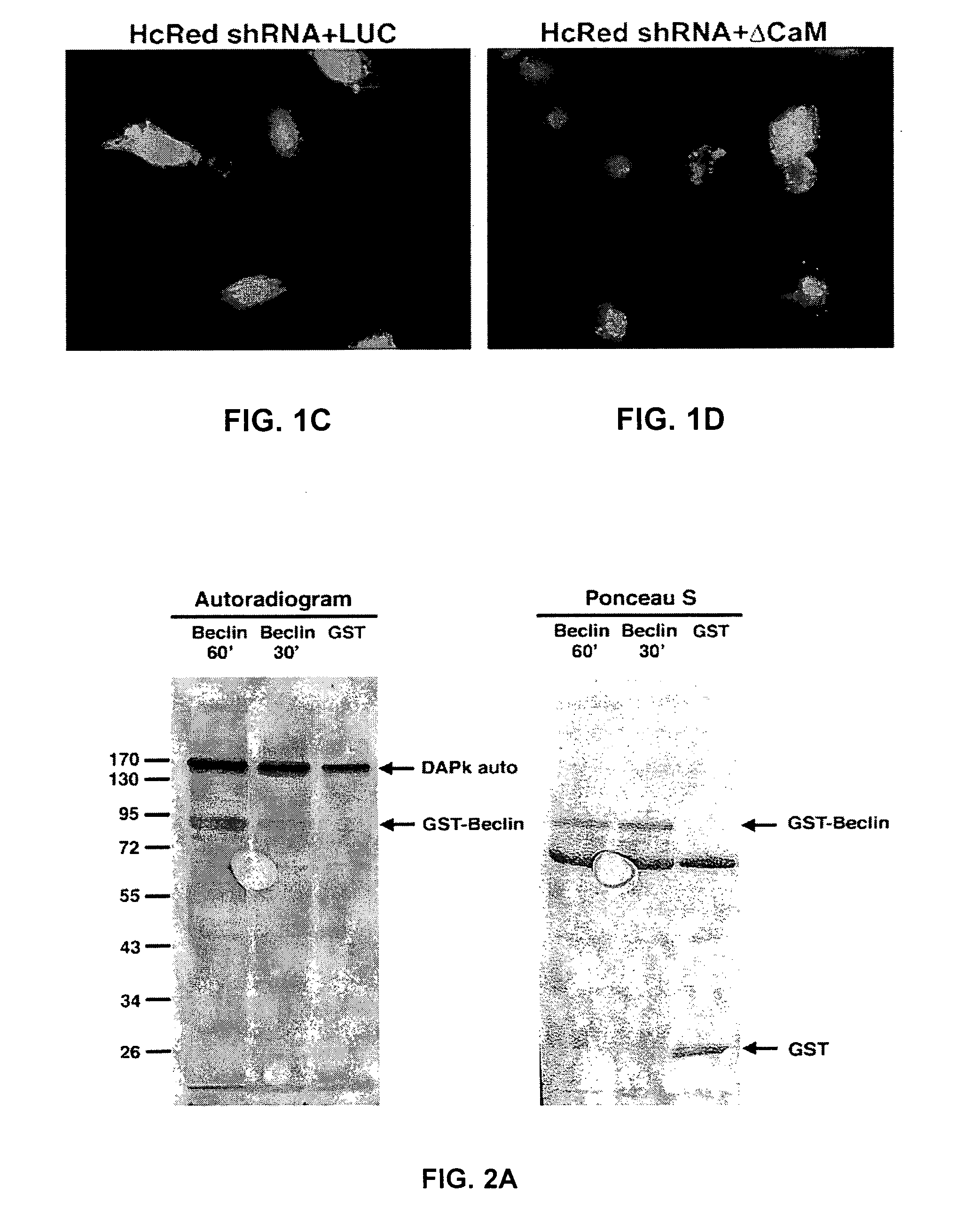 Compositions and methods for diagnosing and treating cancer and neurodegenerative diseases related to beclin-1