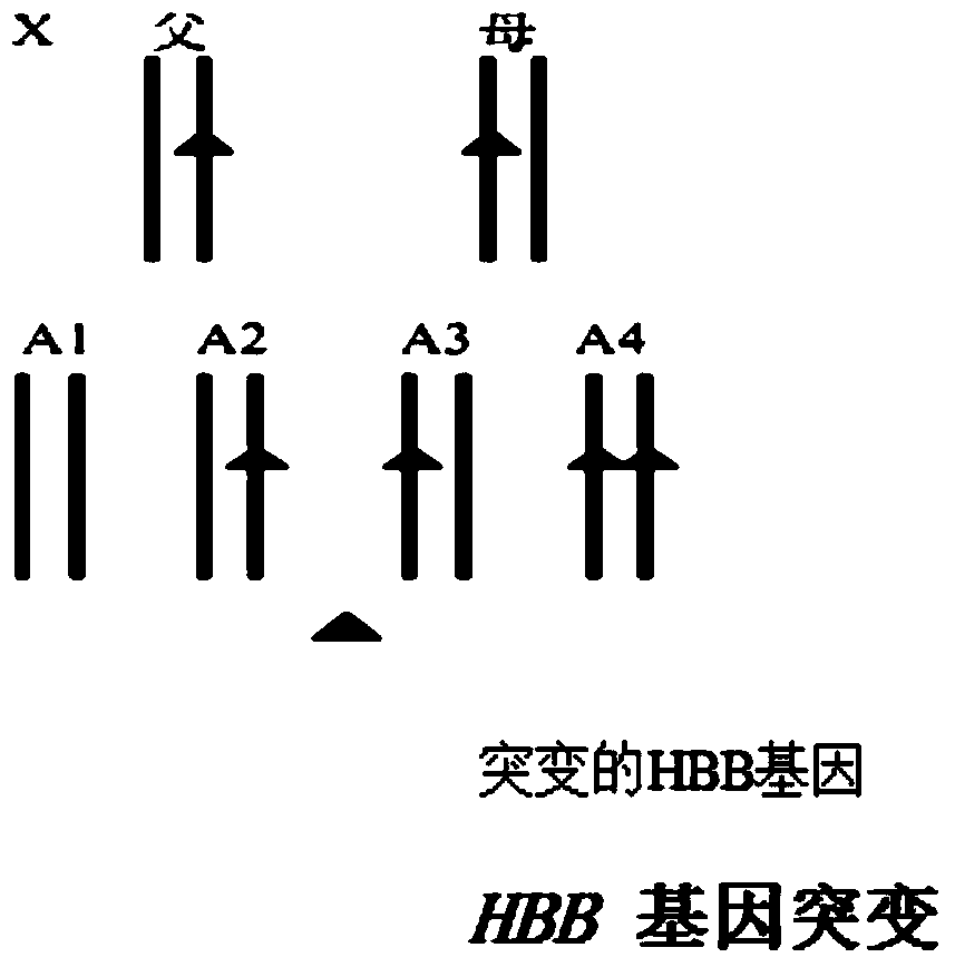 hbb gene mutation and hla typing detection kit