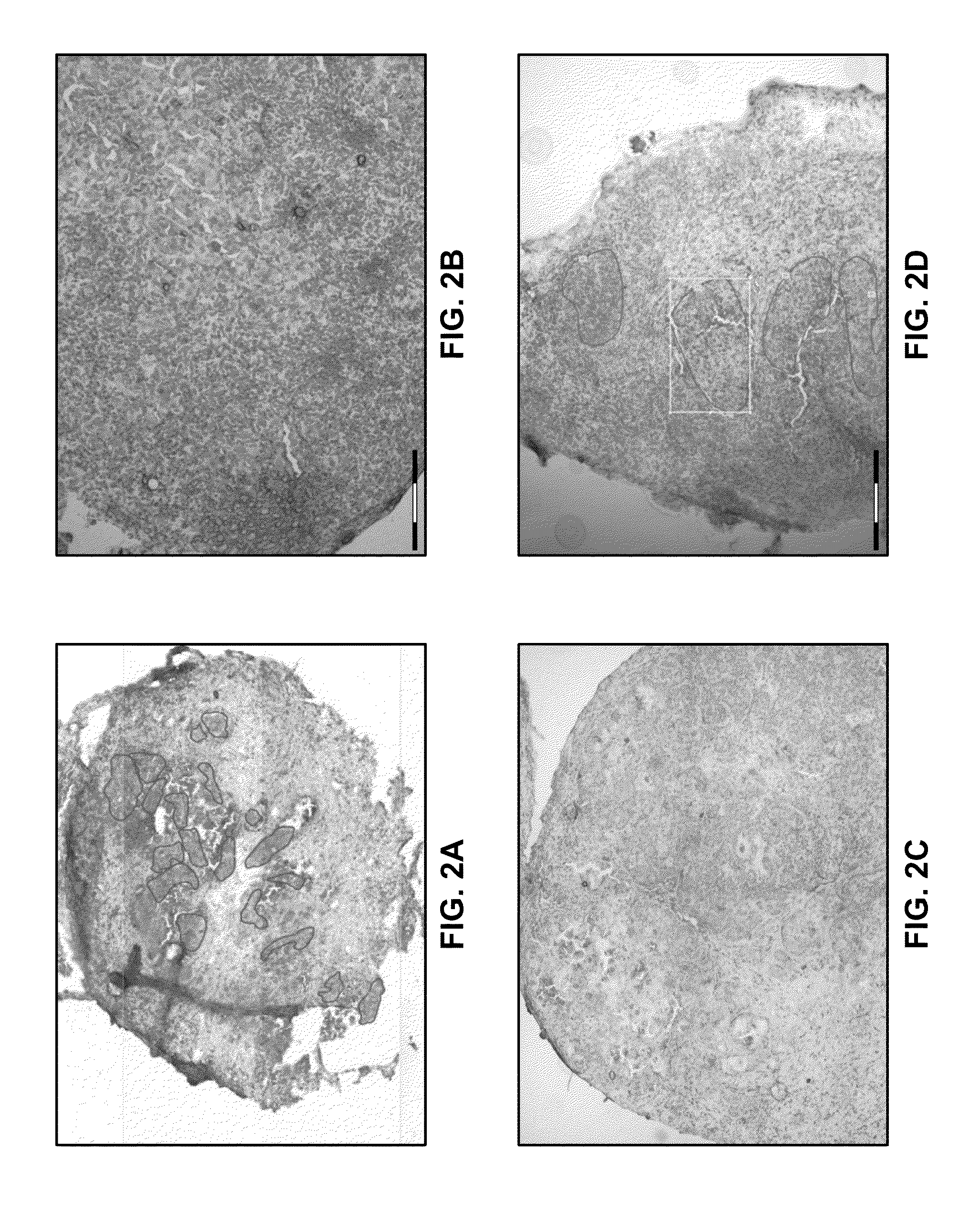 Markers for cancer prognosis and therapy and methods of use