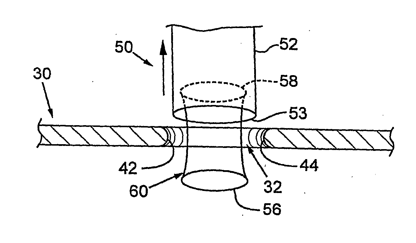 Interfacial stent and method of maintaining patency of surgical fenestrations