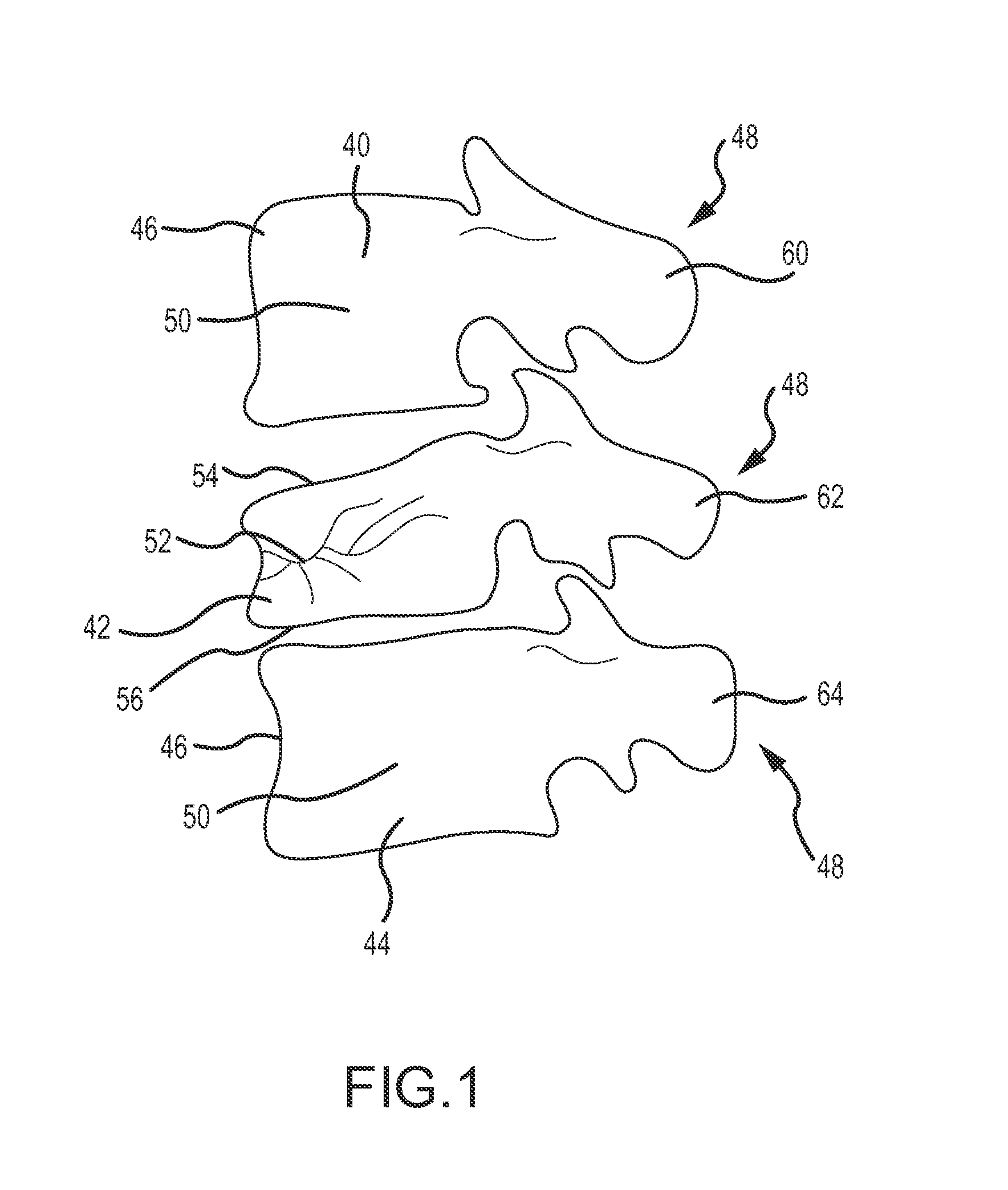 Methods for compression fracture treatment with spinous process fixation systems