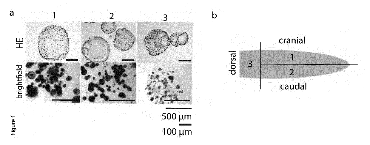 Culture Method for Head and Neck Organoids