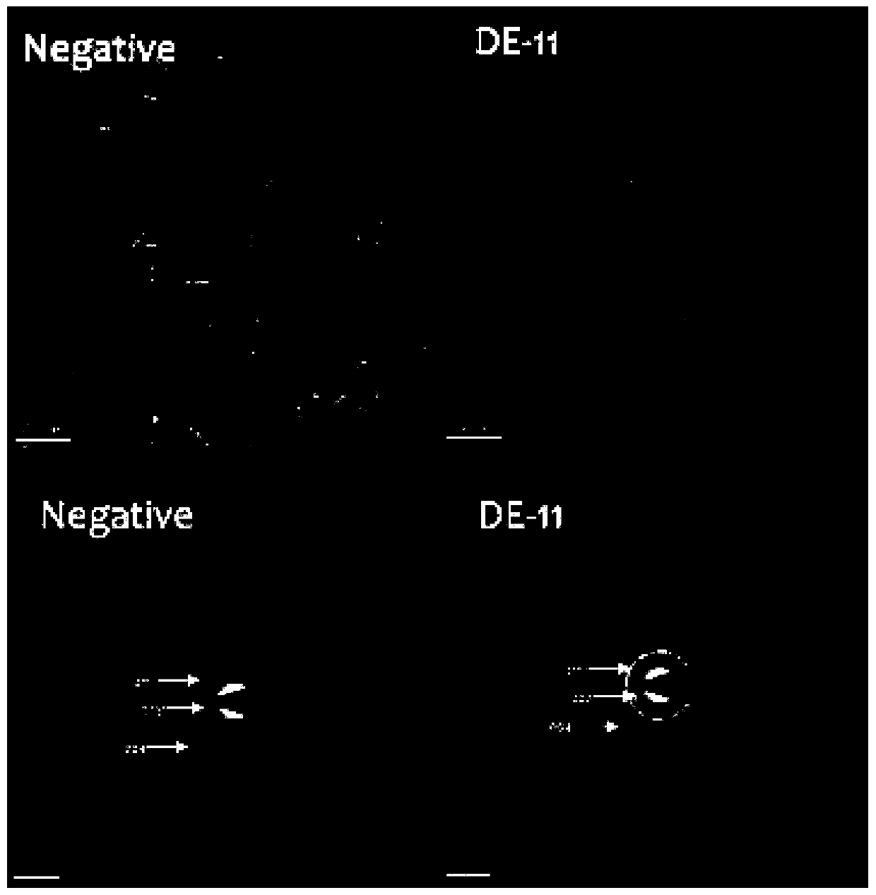 Biomimetic anti-caries polypeptide based on salivary statherin, its derivative and salt and application