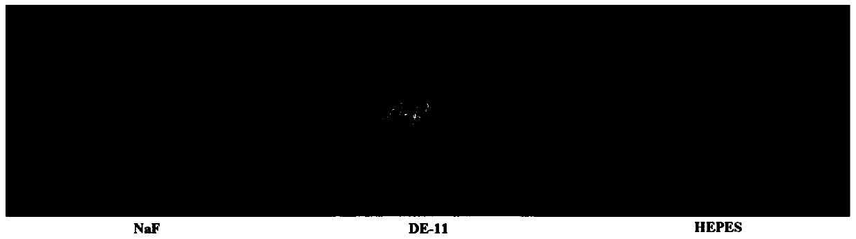 Biomimetic anti-caries polypeptide based on salivary statherin, its derivative and salt and application