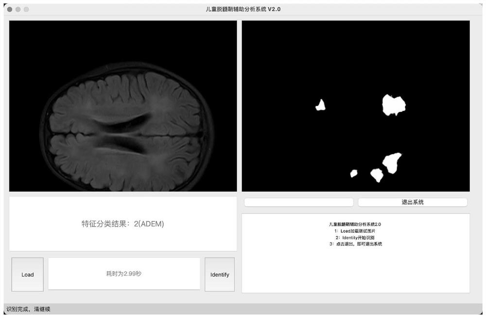 Deep fusion learning-based child brain MRI demyelination auxiliary analysis method